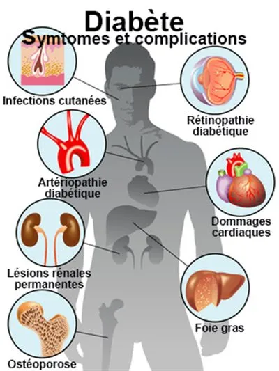 La pollution chimique impliquée dans l'obésité et le diabète