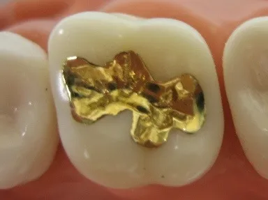 Affaire à la Région Guyane : subvention de 300 000 € attribuée à une dentiste