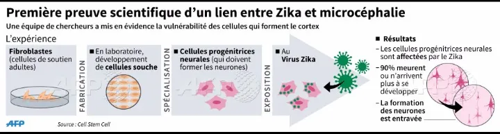 Première preuve scientifique d'un lien entre zika et la microcéphalie du foetus