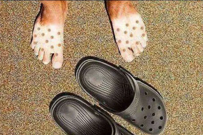 Quand on bronze avec des Crocs...