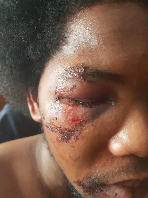 Violences policières...quand la France est sourde, aveugle et a la mémoire courte et…blanche