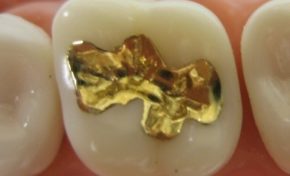 Affaire à la Région Guyane : subvention de 300 000 € attribuée à une dentiste