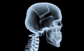 L’île aux 40% plus chers.