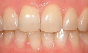 Là...mord dans l'âme