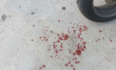 Coups de feu au Paparazzi en Martinique. ..un vigile blessé