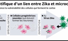 Première preuve scientifique d'un lien entre zika et la microcéphalie du foetus
