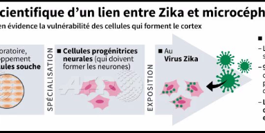 Première preuve scientifique d'un lien entre zika et la microcéphalie du foetus