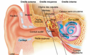 Vous pouvez crever en silence en Martinique