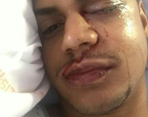 🎶Sur le pont🎵 d'Avignon 🎼on tabasse, on tabasse,  🎶sur le pont d'Avignon on tabasse en silence