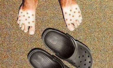 Quand on bronze avec des Crocs...