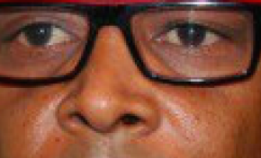 Législatives 2017 : énième manipulation  d'un niloriste en direct sur Martinique 1ère Radio