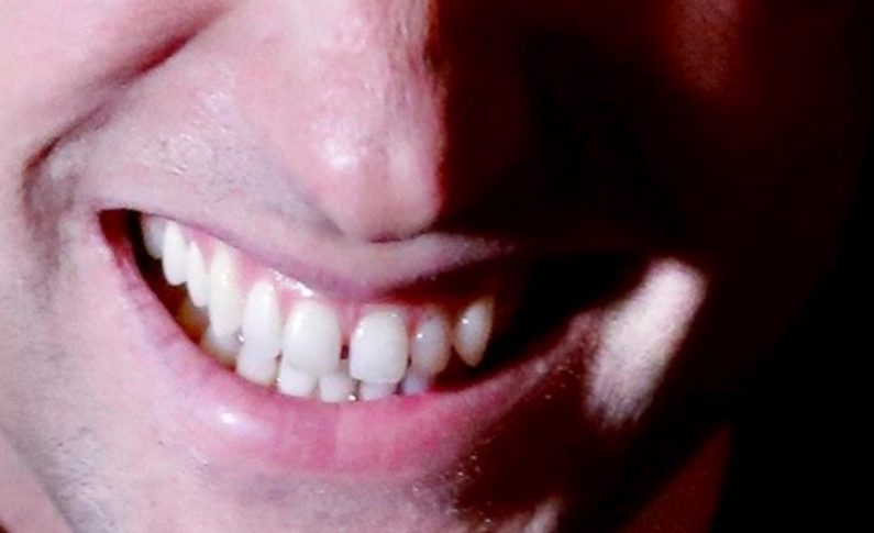 Dossier ATV : le président Miguel Limol de retour sur le dancefloor