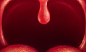 Martinique : sale hiver nos élus glandent...c'est la luette finale