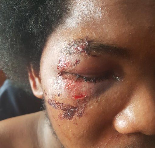 Violences policières...quand la France est sourde, aveugle et a la mémoire courte et…blanche