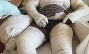 Martinique : Jovany Six...la victime qui dérange ALBIOMA mais pas que...