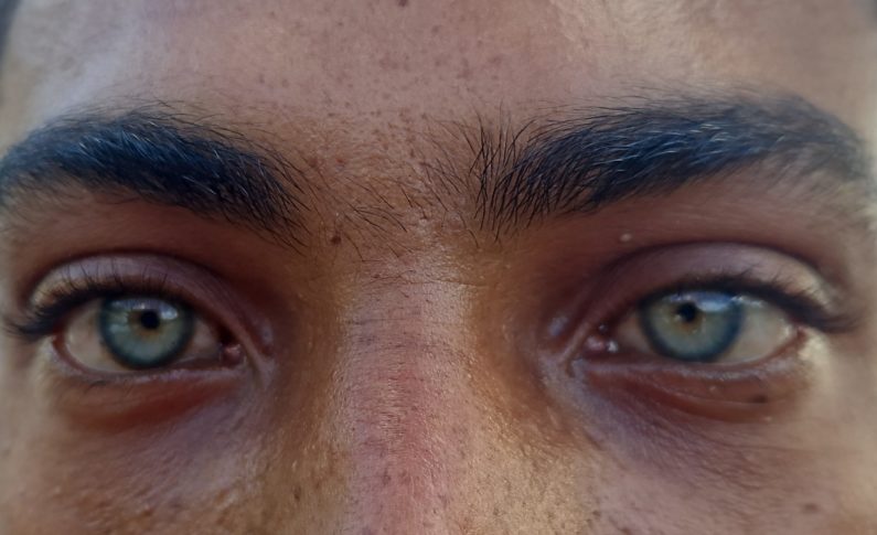 🎶🎶Ouvè zyé'w gadé réalité a"🎶🎶