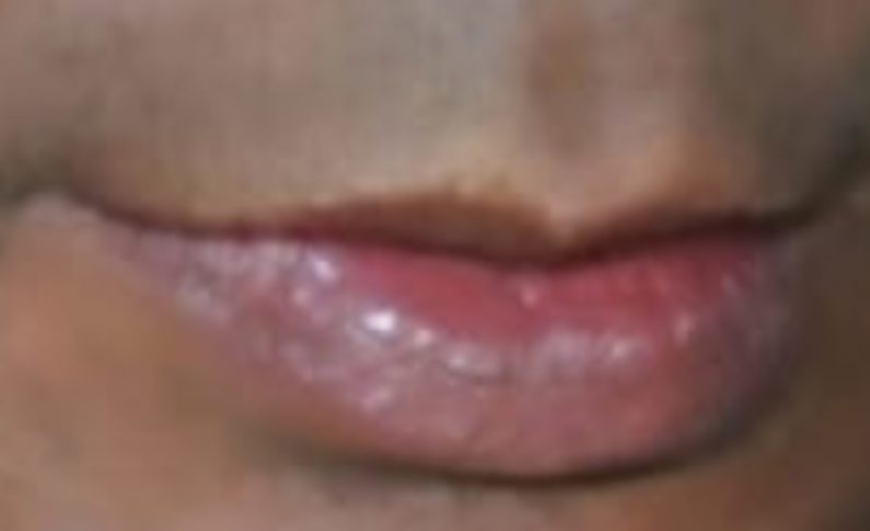 À qui appartient cette bouche ?